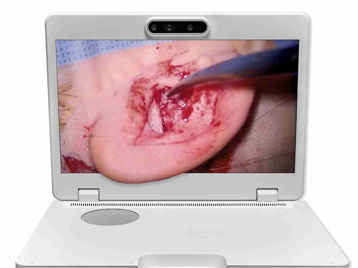 达擎之＂Heads-up 3D显微手术显示系统＂，，整合4K裸眼3D显示及眼球追踪系统，，，，具备快速追踪人眼移动位置功能，，减轻医师长时间维持固定姿势的负担，，，让医师能有更宽广清晰的3D立体视野及更舒适的姿势来执行手术。。。。